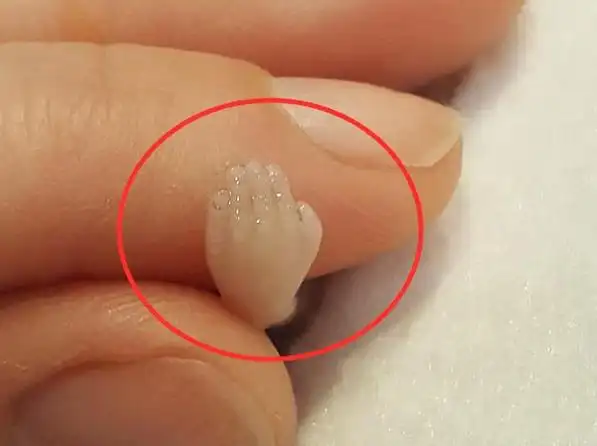 女子怀孕14周后流产,"胎儿"照片曝光,仅10厘米但手脚都已成型