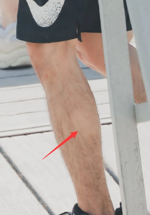 肖战路透照腿毛缺了一块被粉丝调侃站姐都不背锅就是秃了