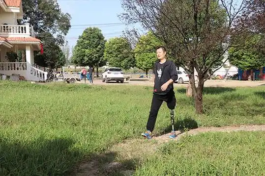 穿戴假肢有哪些小技巧?_包布_大腿_阀门