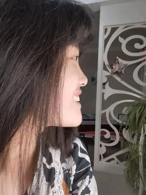 侧脸好丑啊我之前箍了2年半的牙齿原来下巴还不翘起来的现在又长又翘