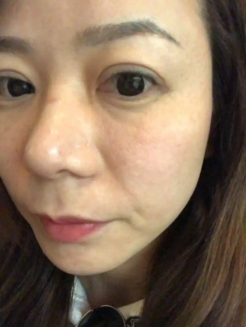 皮肤暗淡无光 毛孔粗大