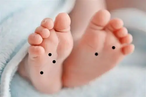 孩子身上这4个地方长痣从小就是富贵命许多爸妈不知道