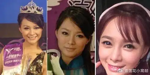 沈梦辰脸部僵硬疑似再整容,回顾出道至今的照片,变化惊人