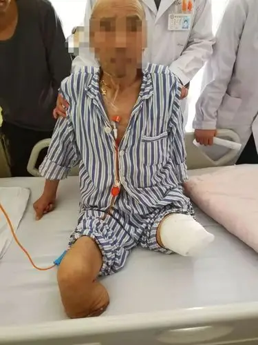 太吓人河北一男子双腿被截肢竟是因为你几乎也天天做