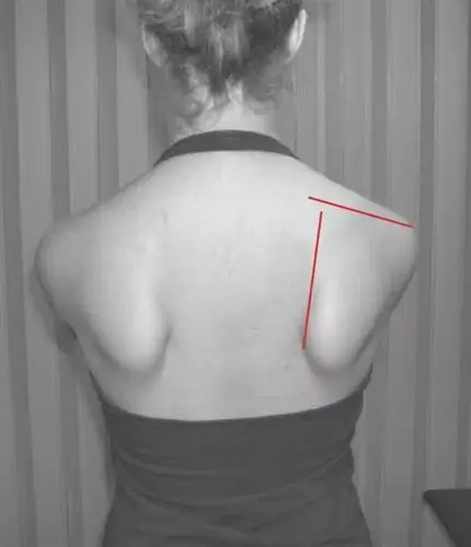 如何锻炼前锯肌