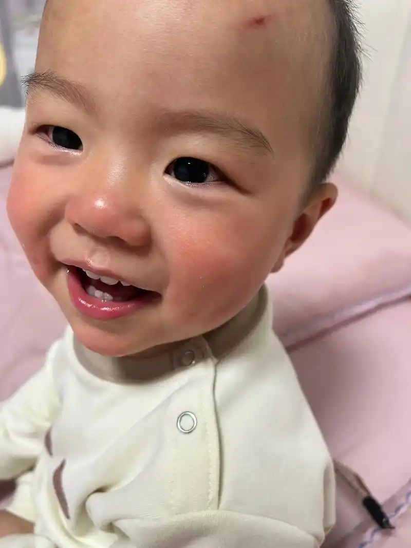 宝宝红屁股脸蛋福音啊～丝塔芙大白罐