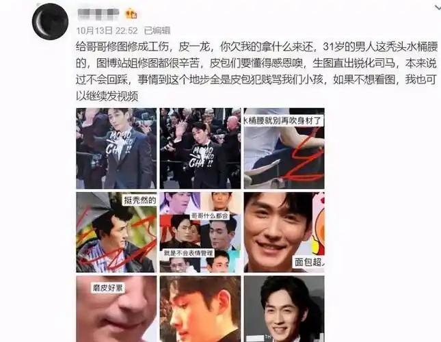 原创朱一龙被爆整容生图比精修图还能打脸部状态时好时差