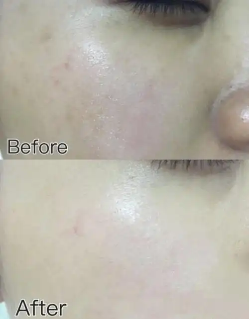 经常熬夜脸色暗黄如何让皮肤状态一夜回春