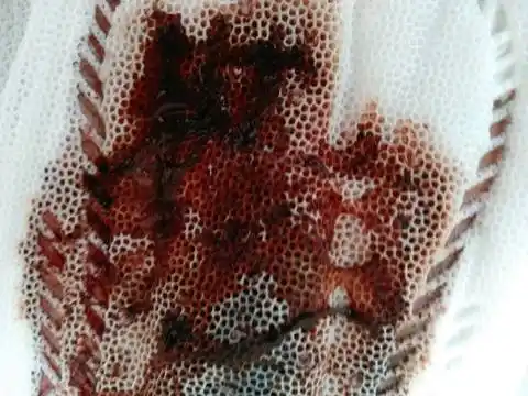 连续好几天了都还没干净,是着床出血还是.要不要去医院检查一下?