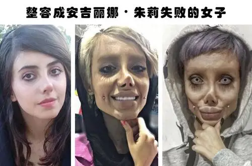 整容失败的代价:据说因为整容而毁掉了自己容貌的6个人