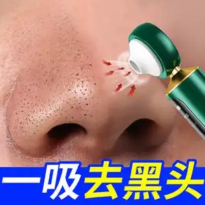去黑头鼻贴收缩毛孔祛粉刺闭口深层清洁神器男女士学生草莓鼻专用