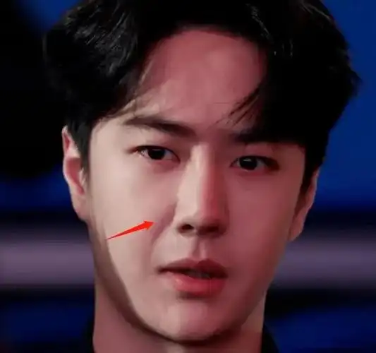 王一博的鼻梁常常会透出微光,而在特写镜头下,鼻翼两侧还会显现出疤痕