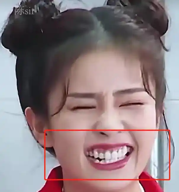 女星白鹿笑容太"丑"惊呆网友,又一个被烤瓷牙祸害的明星?