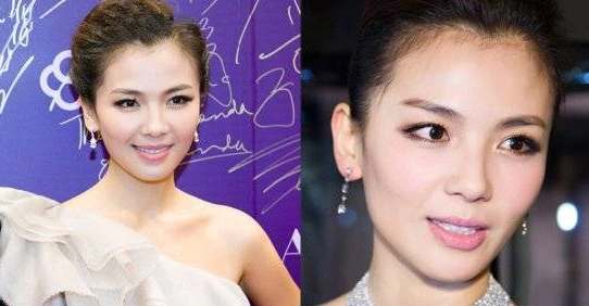 刘涛整容前后照片对比