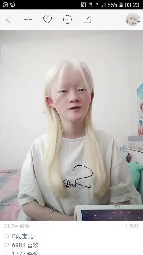 中国人得了什么病是白头发白皮肤?