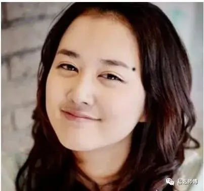 看看你是「富婆命」还是「保姆命」 脸上这些地方长痣的人,天生好命