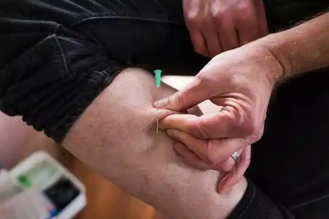 玩一次皮肤穿刺让我克服了自己的针头恐惧症丨vice