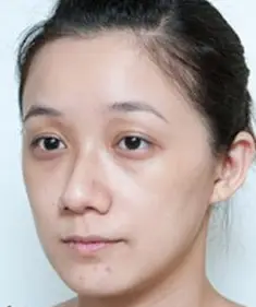 每天用它敷面膜,十五天眼袋消失看不见_肌肤_番茄_砂糖