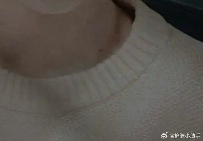 贺峻霖##贺峻霖的锁骨痣##贺峻霖锁骨上有颗痣