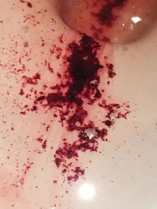 姨妈血有碎的血渣