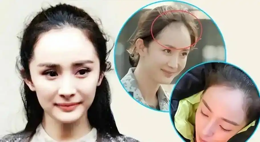 杨幂17岁时就被成龙搂在怀中,举止亲密,对比照揭露杨幂整容真相