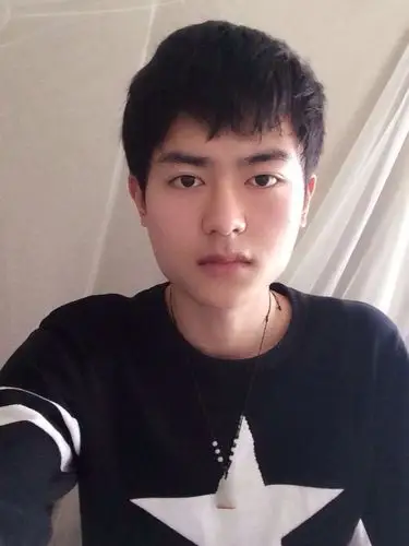 男生做下颌角截骨手术真实案例分享