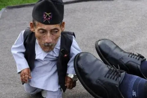 世界上最小的人钱德拉身高仅0546米体重仅12公斤