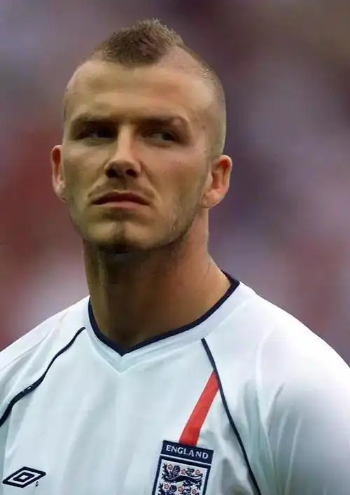 男神小贝惨变秃又大反转到底发生了什么