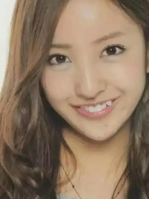 作为对虎牙极致推崇的日本,不少明星都是带着虎牙出道,以亲切感俘获