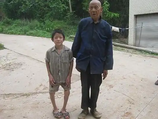 佝偻病的早期症状 (24)