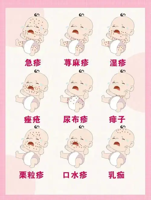 一分钟辨别91566种宝宝常见皮肤病!建议爸妈收藏