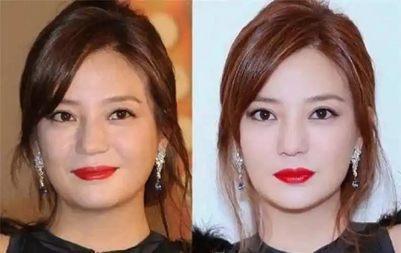 想轻松去除双下巴,快和戚薇学学吧,这些小技巧让你重获少女线_下颚