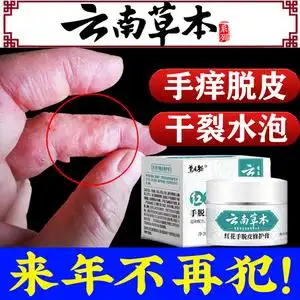 00166人付款淘宝手部克星专用手脱皮治疗水泡湿疹手癣手气藓药膏真菌