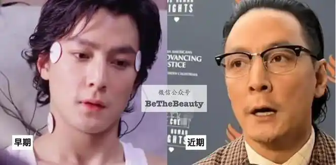 混乱起来,是可以很狂野:▲白敬亭就被扒经常熬夜▲钟丽缇早睡早起▲披