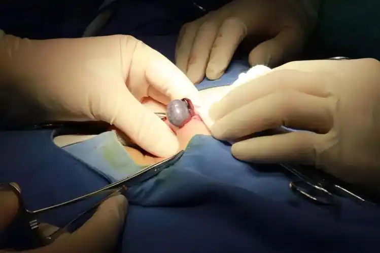 孩子"蛋疼"事儿不小 切莫耽搁救治时机