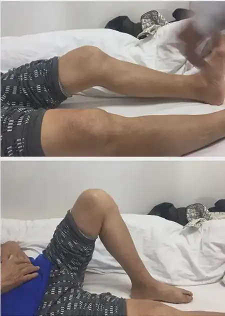 【医技精湛】膝关节置换术后康复的重要性