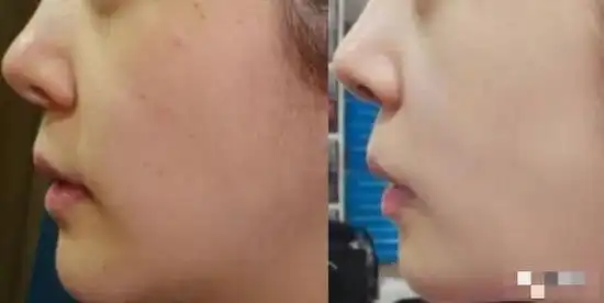 从内到外改善肌肤让皮肤真正的水嫩光滑拒绝不健康"激素美容"以全方位