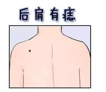 这三个部位有痣,一生财运都不差,多贵人