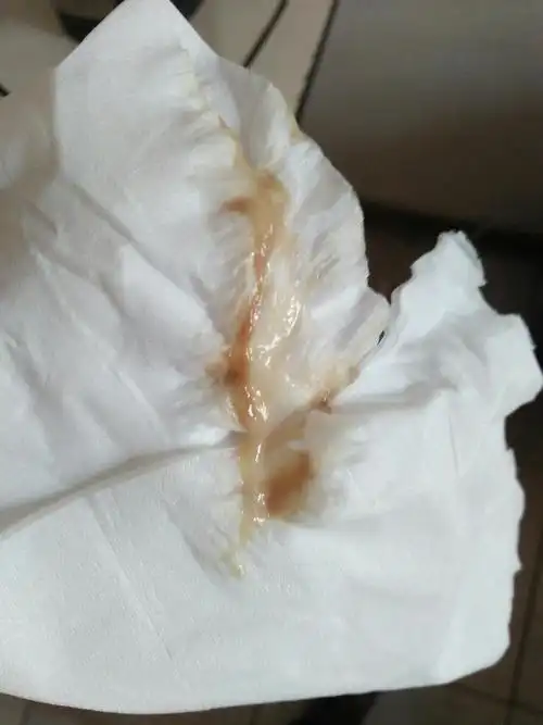 这是褐色分泌物吗?该怎么办?