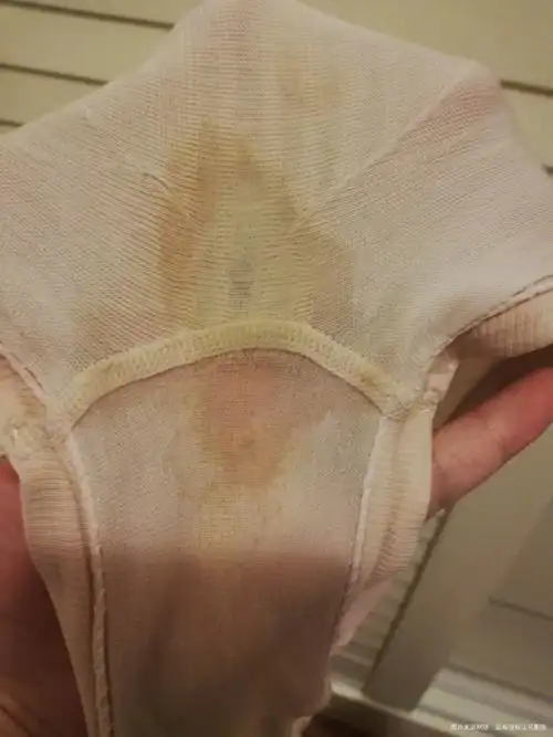 孕18周会不会胎膜早破