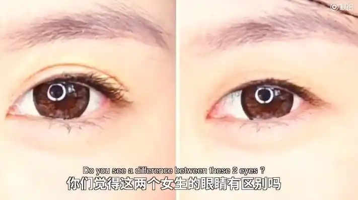 单眼皮好看还是双眼皮好看?老外:啥是眼皮?