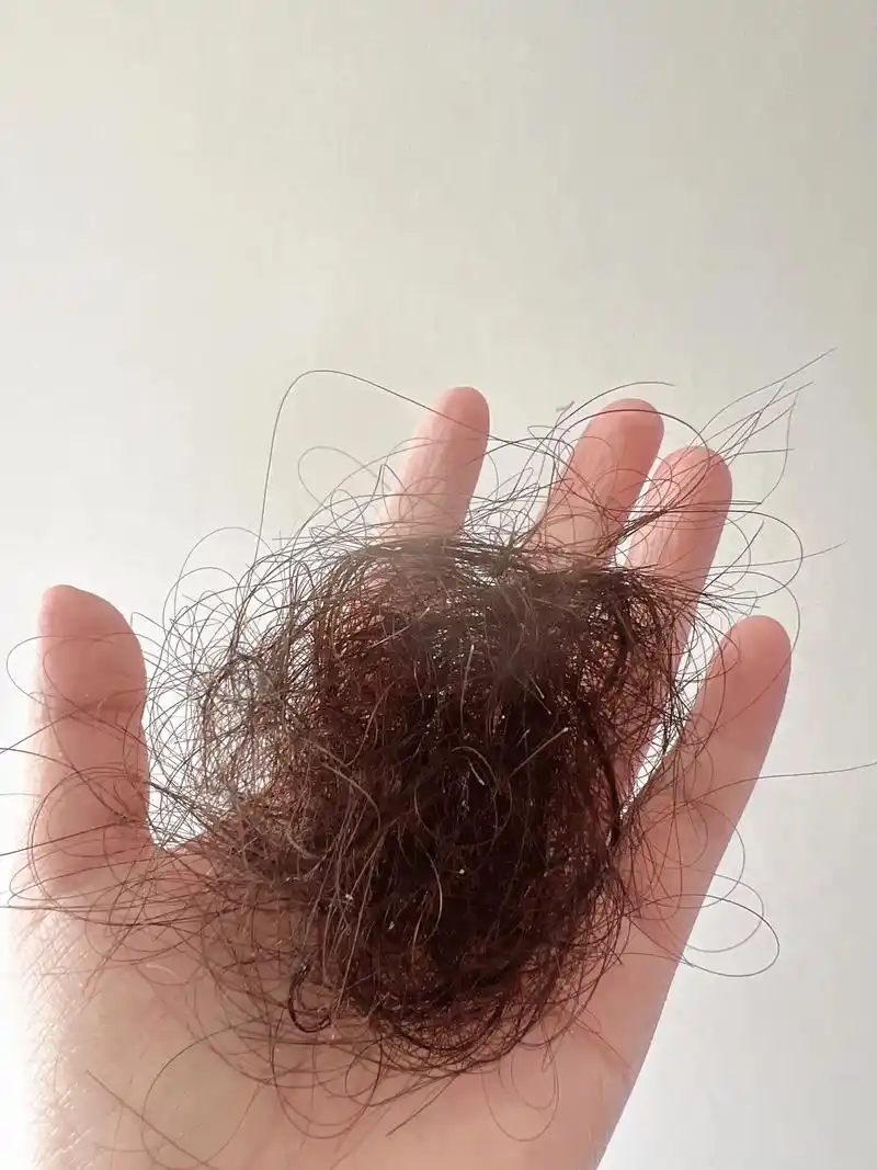 三月认母掉头发.产后脱发从不迟到,我的头发它在地板上,在床上 - 抖音