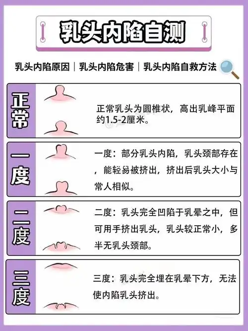 女性私密话题乳头内陷的原因