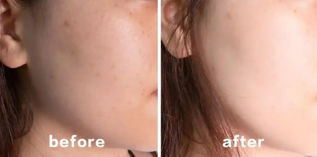 (官网消费者对比图,效果跟我差不多)