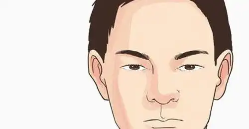 男人额头面相是什么样的好