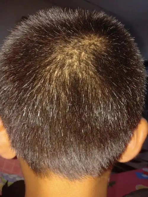 各位朋友们有没有什么好方法好办法 ,哎呀,快愁死我啦 .