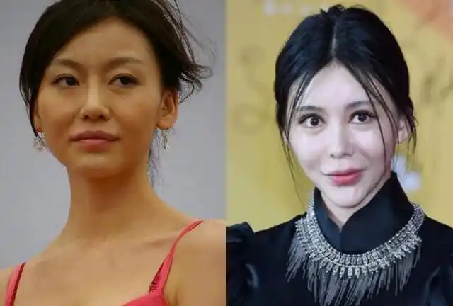 范玮琪可能是里最会整形的女明星十几年都在变脸但一点看不出