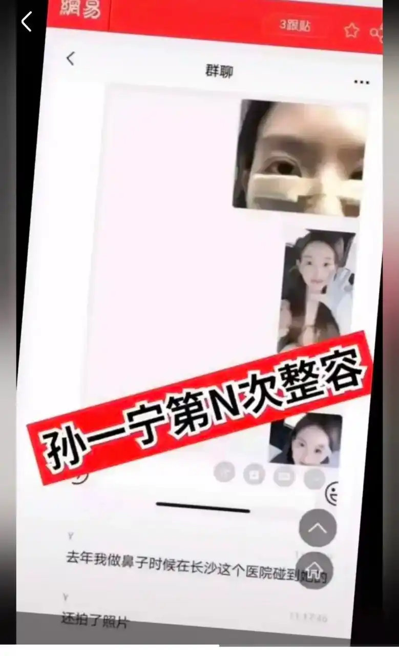 网上爆出孙一宁整容,聪哥终于发力了,不过说实话吧,所谓的孙一宁整容