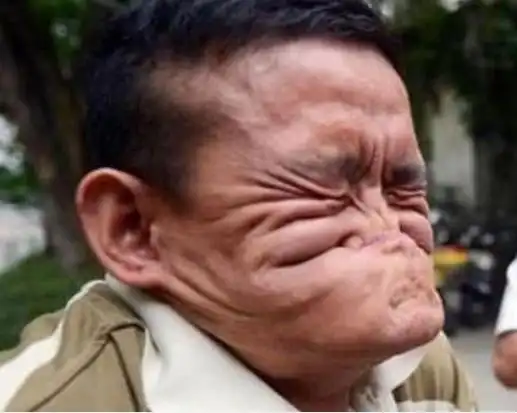 世界上竟有这么丑的人还是世界纪录拥有者职业让人意外