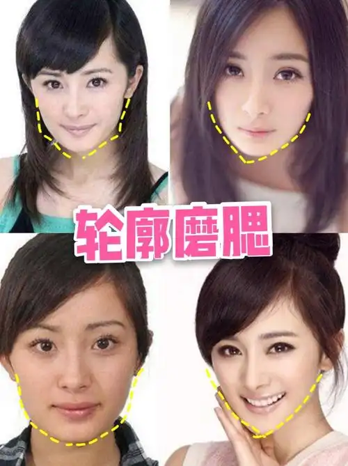 换头级选手之第二位——杨幂到底对自己do了啥?